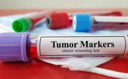 Onkoloji: Kanserle Mücadelede İlerlemenin Anahtarı