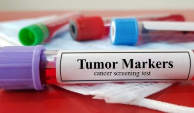 Onkoloji: Kanserle Mücadelede İlerlemenin Anahtarı